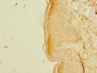 RBM41 Antibody in Immunohistochemistry (Paraffin) (IHC (P))