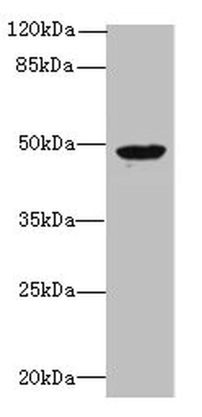 RBM41 Antibody in Western Blot (WB)