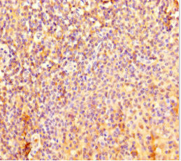 IL4I1 Antibody in Immunohistochemistry (Paraffin) (IHC (P))