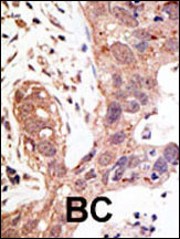 SENP1 Antibody in Immunohistochemistry (Paraffin) (IHC (P))