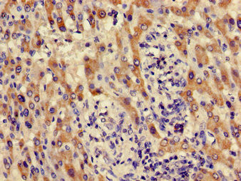 ACMSD Antibody in Immunohistochemistry (Paraffin) (IHC (P))