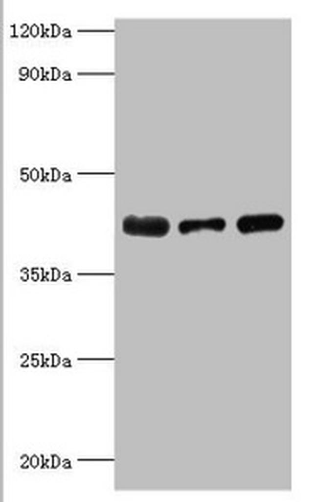 ST8SIA2 Antibody in Western Blot (WB)