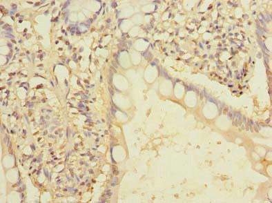 FAM86A Antibody in Immunohistochemistry (Paraffin) (IHC (P))