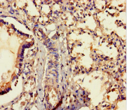 MRAP2 Antibody in Immunohistochemistry (Paraffin) (IHC (P))