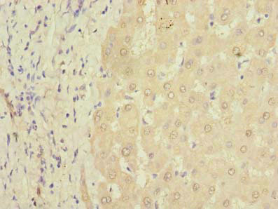 PQLC3 Antibody in Immunohistochemistry (Paraffin) (IHC (P))