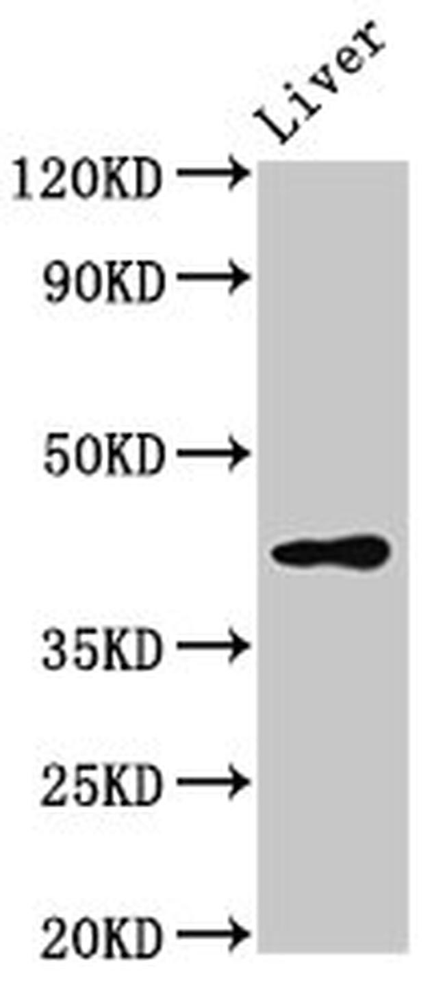 SGMS2 Antibody in Western Blot (WB)