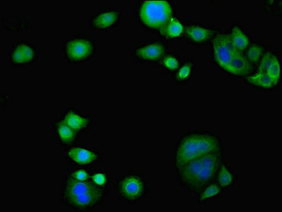 C3orf31 Antibody in Immunocytochemistry (ICC/IF)