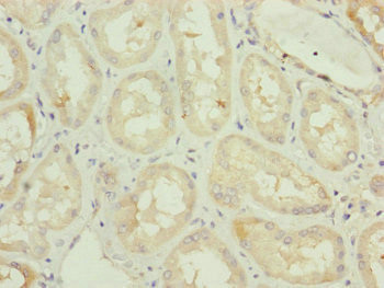 C3orf31 Antibody in Immunohistochemistry (Paraffin) (IHC (P))