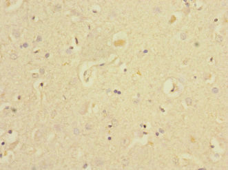 EAF2 Antibody in Immunohistochemistry (Paraffin) (IHC (P))