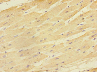 EAF2 Antibody in Immunohistochemistry (Paraffin) (IHC (P))