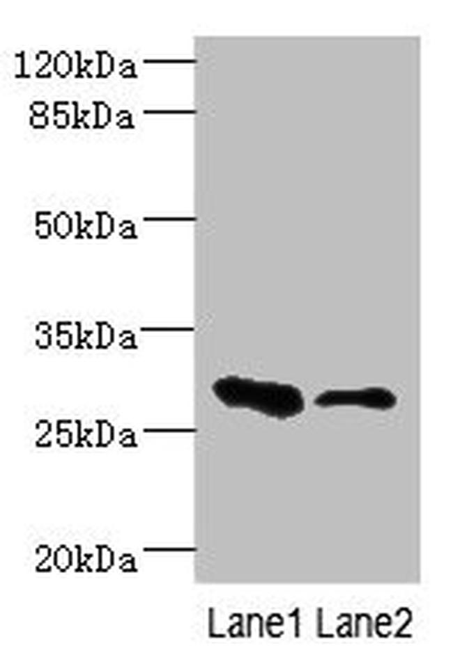 EAF2 Antibody in Western Blot (WB)