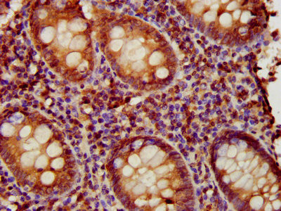 EAF2 Antibody in Immunohistochemistry (Paraffin) (IHC (P))