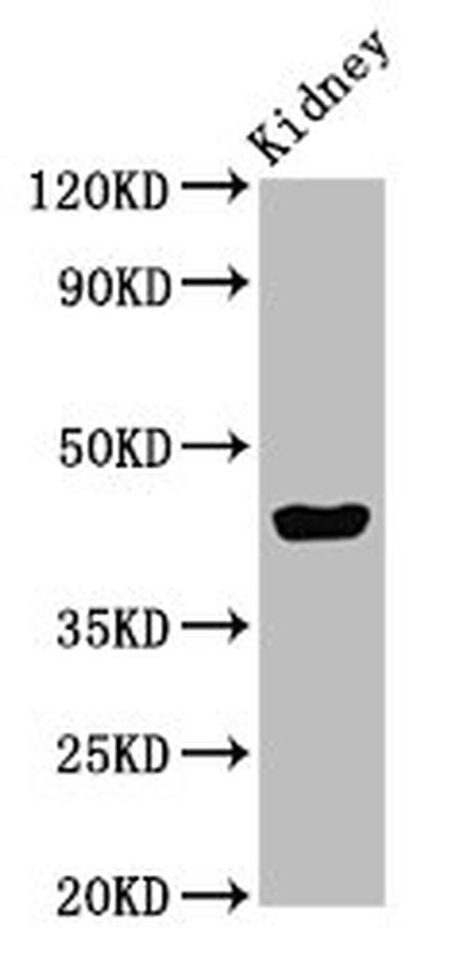 EAF2 Antibody in Western Blot (WB)