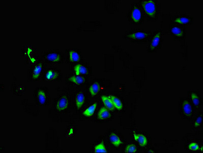 SMO Antibody in Immunocytochemistry (ICC/IF)