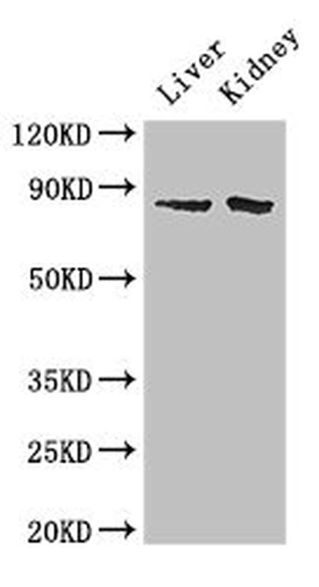 SMO Antibody in Western Blot (WB)