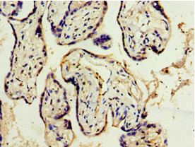 ADAM33 Antibody in Immunohistochemistry (Paraffin) (IHC (P))