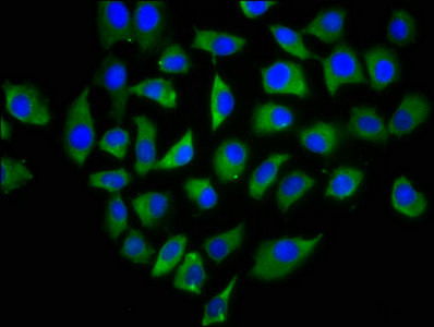 CD299 (DC-SIGN/L) Antibody in Immunocytochemistry (ICC/IF)