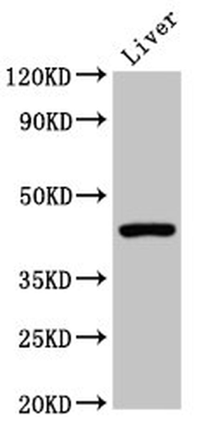 CD299 (DC-SIGN/L) Antibody in Western Blot (WB)