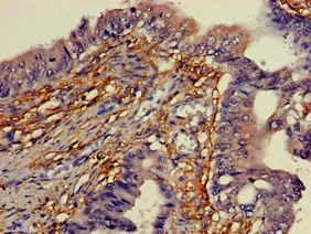 YIPF3 Antibody in Immunohistochemistry (Paraffin) (IHC (P))