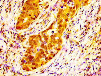 NAT10 Antibody in Immunohistochemistry (Paraffin) (IHC (P))