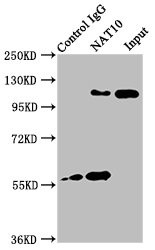 NAT10 Antibody in Immunoprecipitation (IP)