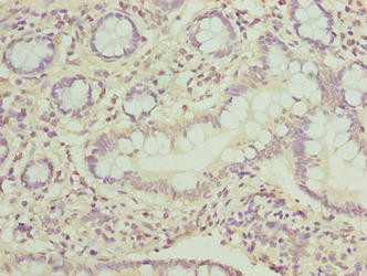 PPIL3 Antibody in Immunohistochemistry (Paraffin) (IHC (P))