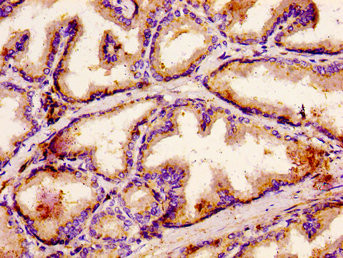 ACBD3 Antibody in Immunohistochemistry (Paraffin) (IHC (P))