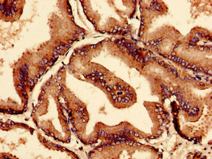 CTPS2 Antibody in Immunohistochemistry (Paraffin) (IHC (P))