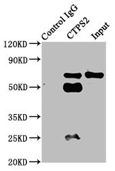 CTPS2 Antibody in Immunoprecipitation (IP)