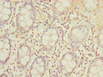 SLC23A2 Antibody in Immunohistochemistry (Paraffin) (IHC (P))