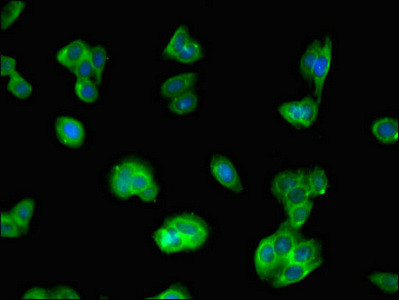 IQCG Antibody in Immunocytochemistry (ICC/IF)