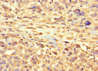 RSPH9 Antibody in Immunohistochemistry (Paraffin) (IHC (P))