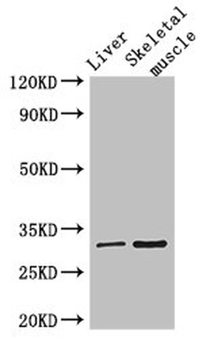 RSPH9 Antibody in Western Blot (WB)