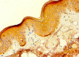 HAUS4 Antibody in Immunohistochemistry (Paraffin) (IHC (P))