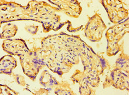 HAUS4 Antibody in Immunohistochemistry (Paraffin) (IHC (P))