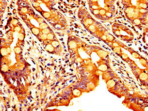 SEMA4B Antibody in Immunohistochemistry (Paraffin) (IHC (P))