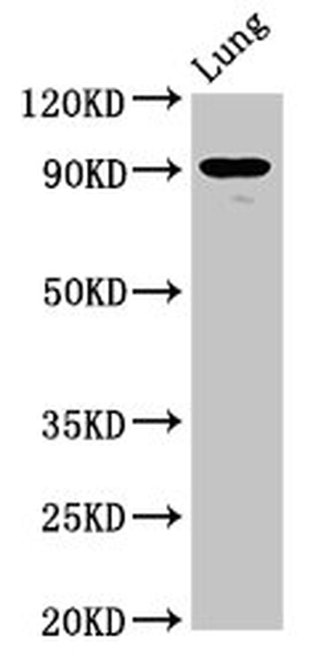 SEMA4B Antibody in Western Blot (WB)