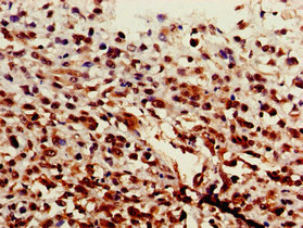 ST6GALNAC1 Antibody in Immunohistochemistry (Paraffin) (IHC (P))