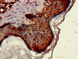 ST6GALNAC1 Antibody in Immunohistochemistry (Paraffin) (IHC (P))