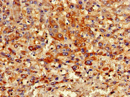 PIPOX Antibody in Immunohistochemistry (Paraffin) (IHC (P))