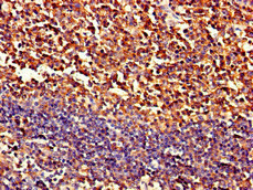 PIPOX Antibody in Immunohistochemistry (Paraffin) (IHC (P))