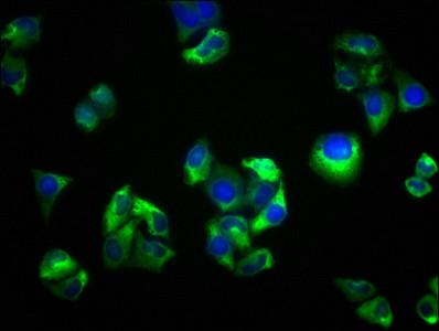 SEMA5B Antibody in Immunocytochemistry (ICC/IF)