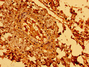 SEMA5B Antibody in Immunohistochemistry (Paraffin) (IHC (P))