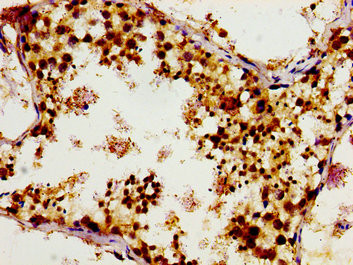 GCP4 Antibody in Immunohistochemistry (Paraffin) (IHC (P))