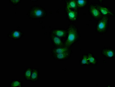 PDCL3 Antibody in Immunocytochemistry (ICC/IF)