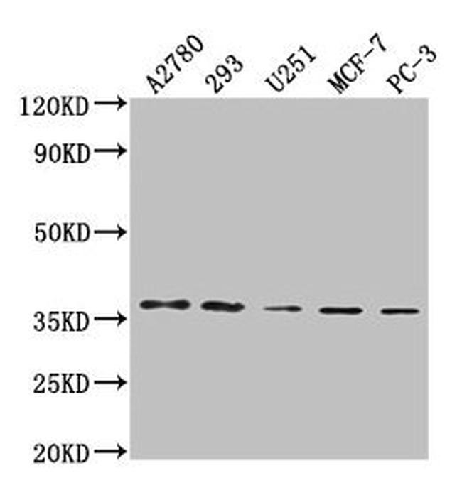 PDCL3 Antibody in Western Blot (WB)