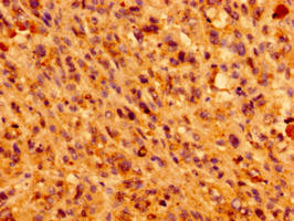 IFT46 Antibody in Immunohistochemistry (Paraffin) (IHC (P))