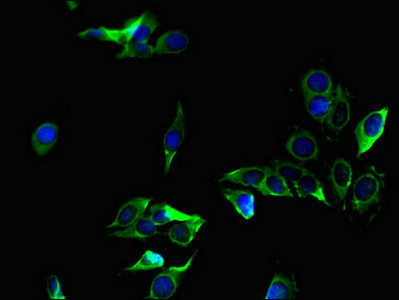 ZC4H2 Antibody in Immunocytochemistry (ICC/IF)