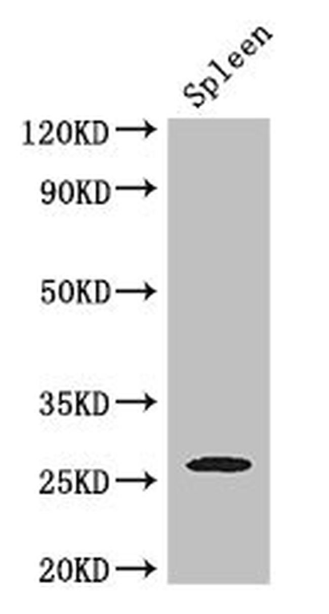 ZC4H2 Antibody in Western Blot (WB)