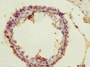 ACSS2 Antibody in Immunohistochemistry (Paraffin) (IHC (P))